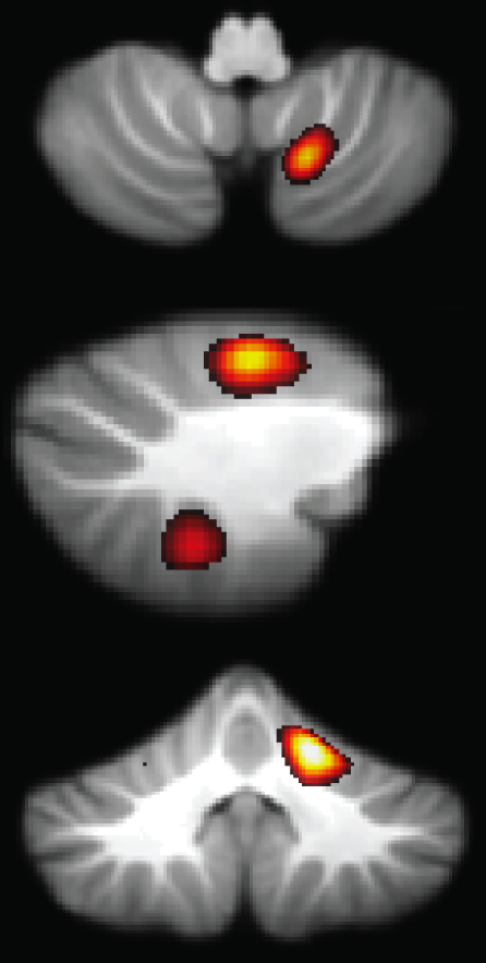 Cerebellar finger representations