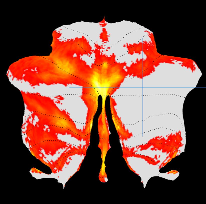 Cerebellar Atlas Viewer