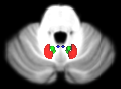 Deep cerebellar nuclei